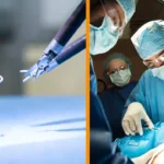 Intuitive Surgical: waarom daalt het aandeel 7% ondanks sterke kwartaalcijfers?